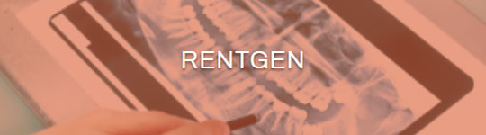 rentgen